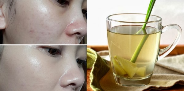 Da trắng mịn như gái Hàn nhờ xông mặt theo cách này